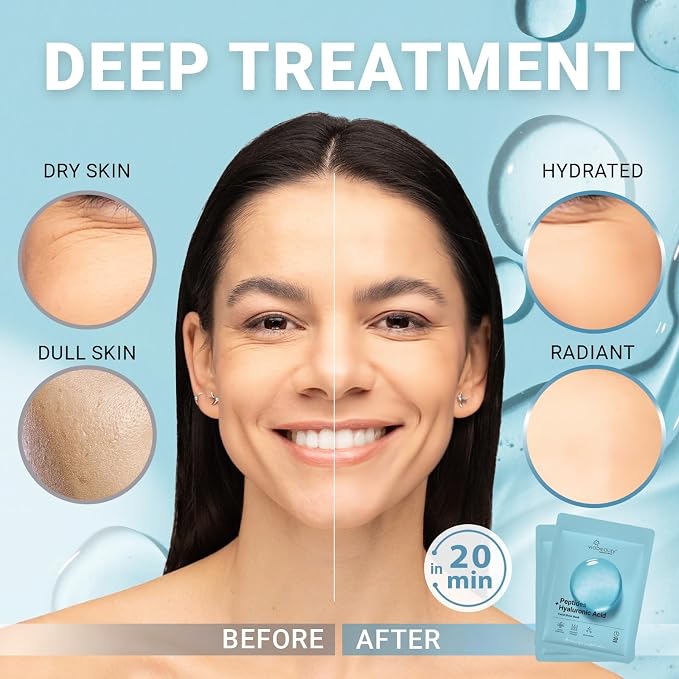 Hyaluronic Acid