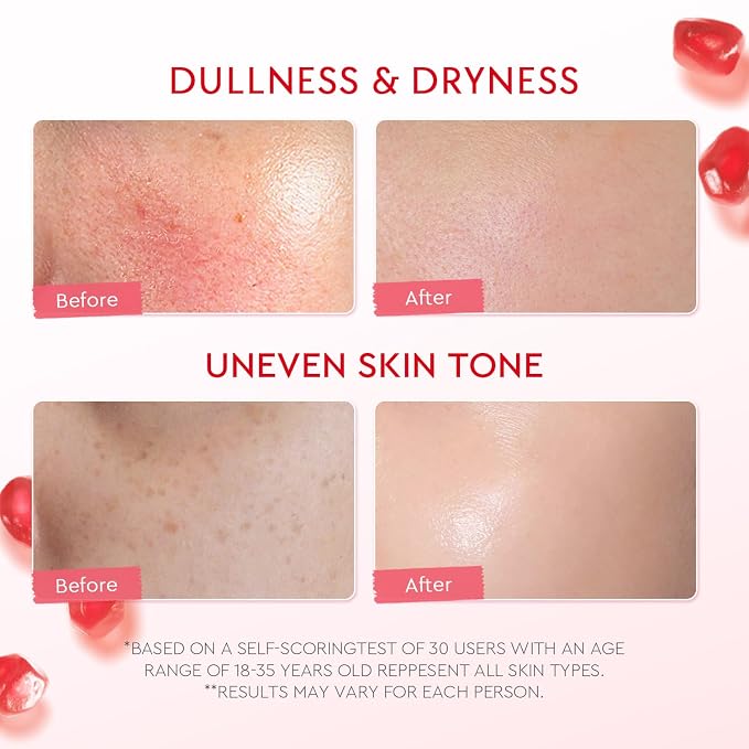 POMEGRANATE 5% NIACINAMIDE