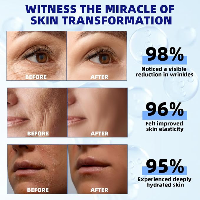 Retinol Serum for Face
