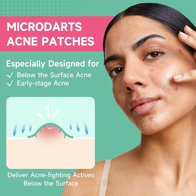 144P Microdart Pimple Patches