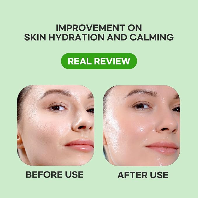 Heartleaf Calming Serum Mask -5pk