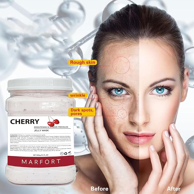 CHERRY