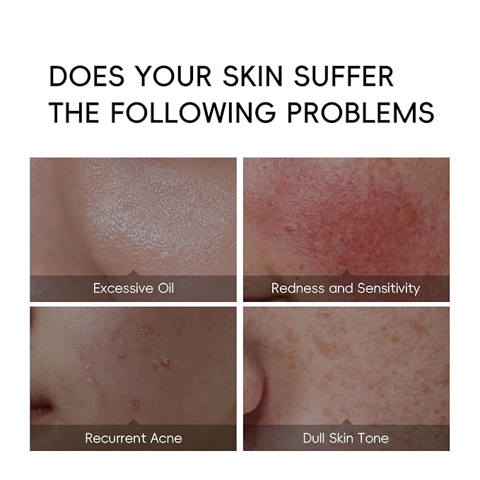 Turmeric Skin Care Set