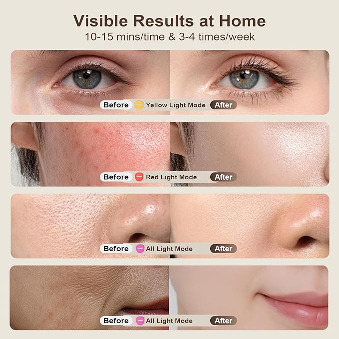 Skin Tone