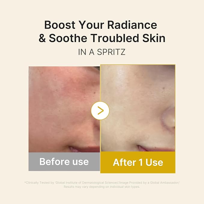 Kojic Acid Turmeric