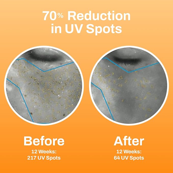 0.3% Retinol