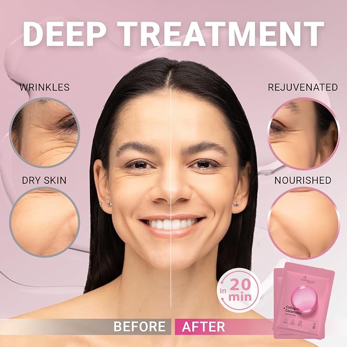 Collagen