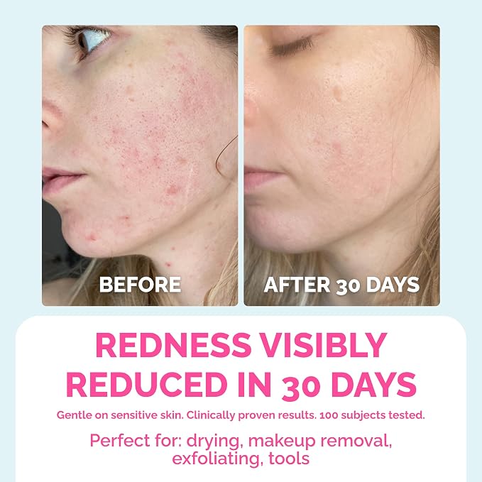 __DEFAULT__