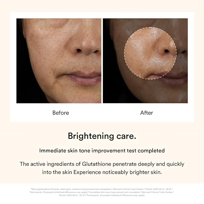 Dark Spots (Glutathione)