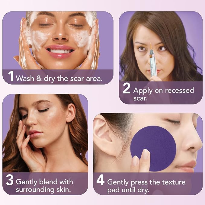 Tan