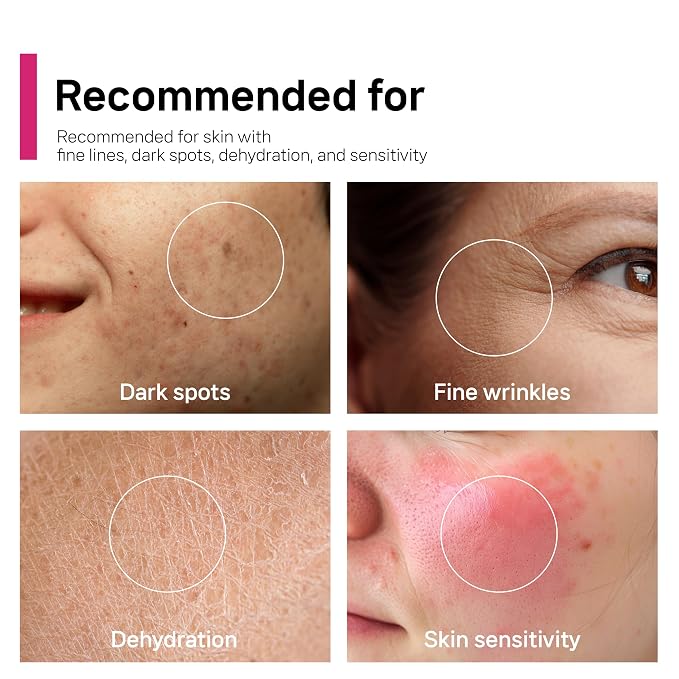 ArbuTXA Cream