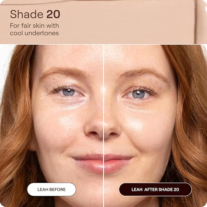 Shade 20