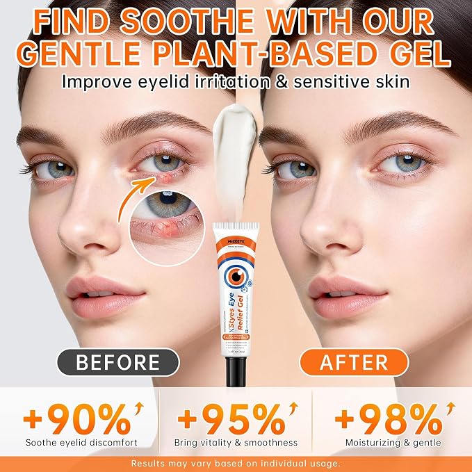 Eye Relief Gel - 1PCS