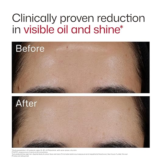 09 - New Blemish Prone (0.5 oz)