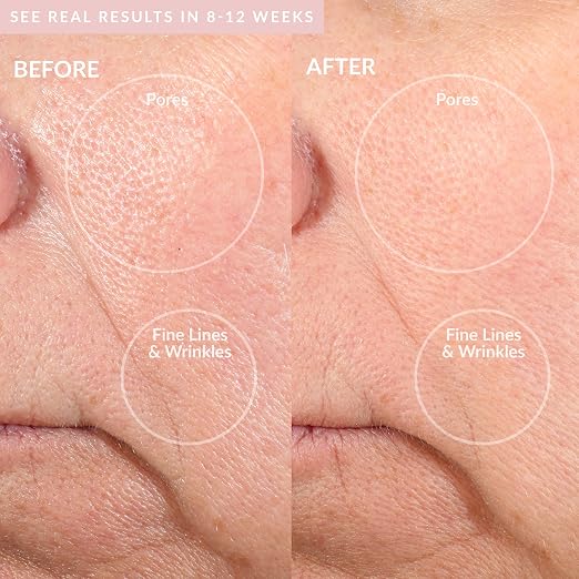 Blush + Recovery Mask