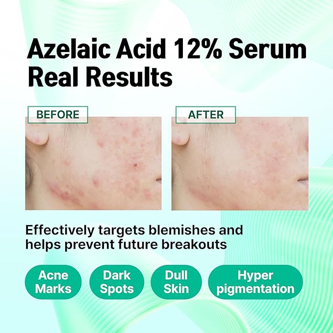 Azelaic Acid