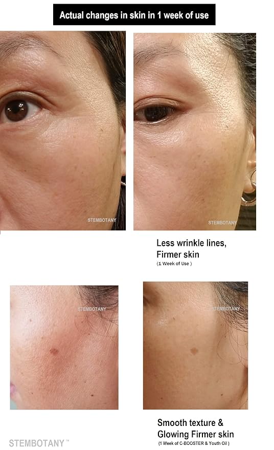 CELL activator