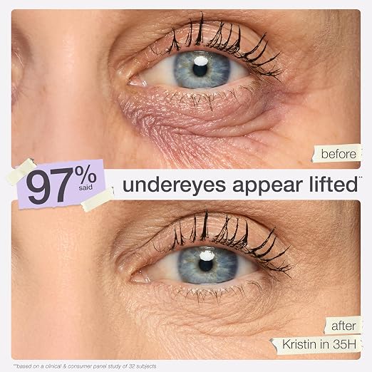 20B light (light skin with cool, pink undertones)