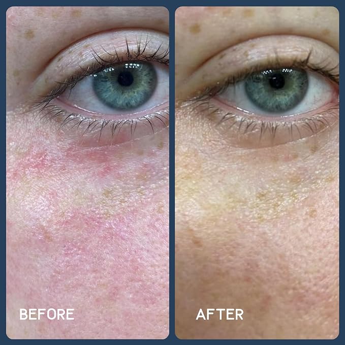 Clear Daily Use Sunshine Serum