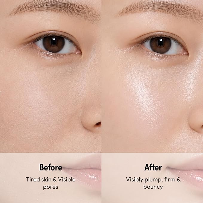 Radiant Glow Kojic Acid