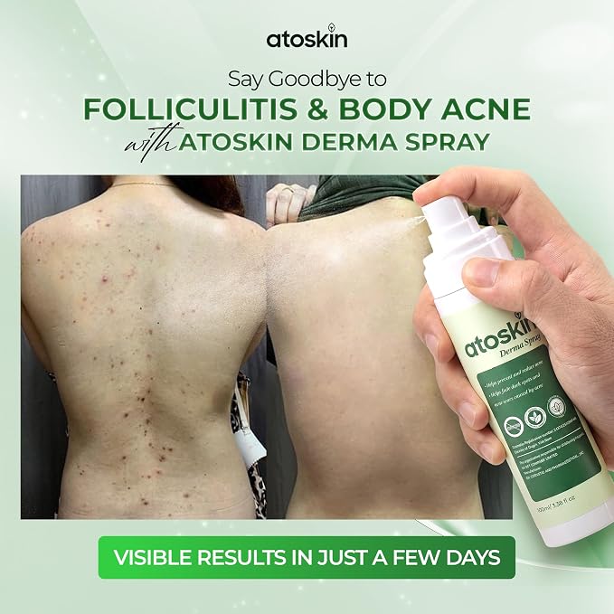1 Derma Spray