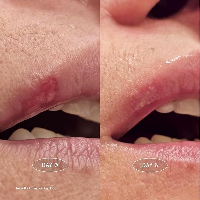 Lip Rescue Serum