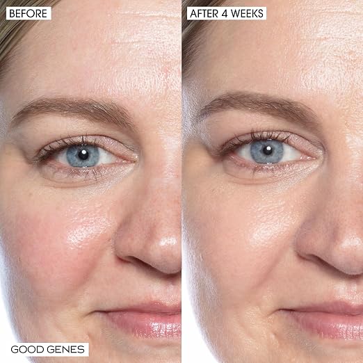 __DEFAULT__