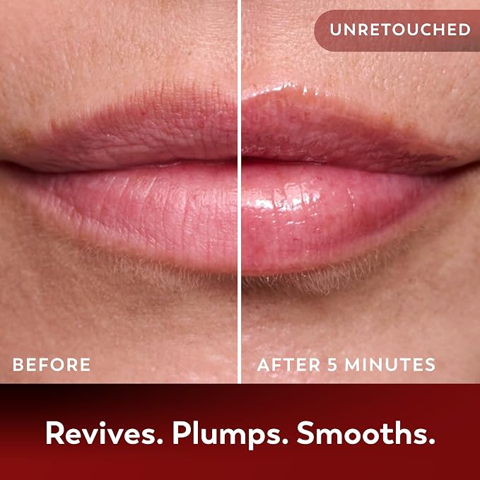 Lip Balm Treatment