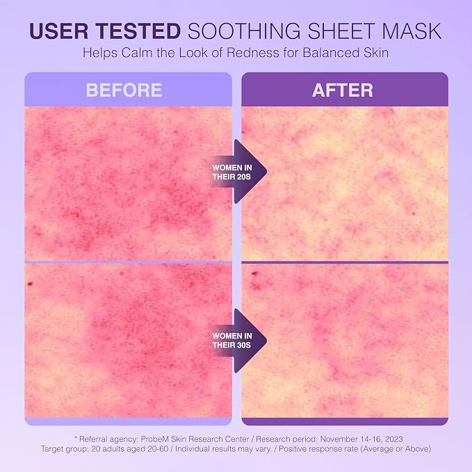 Relief Radiance