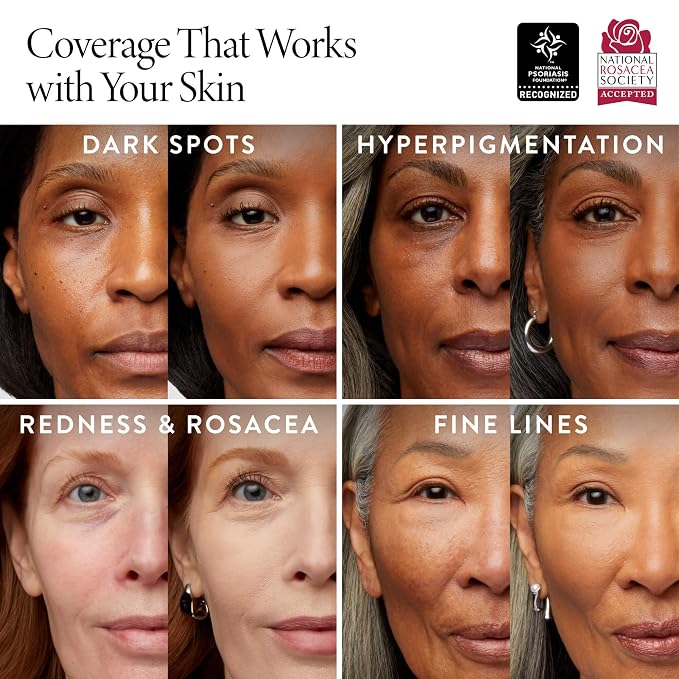 05 Golden Medium