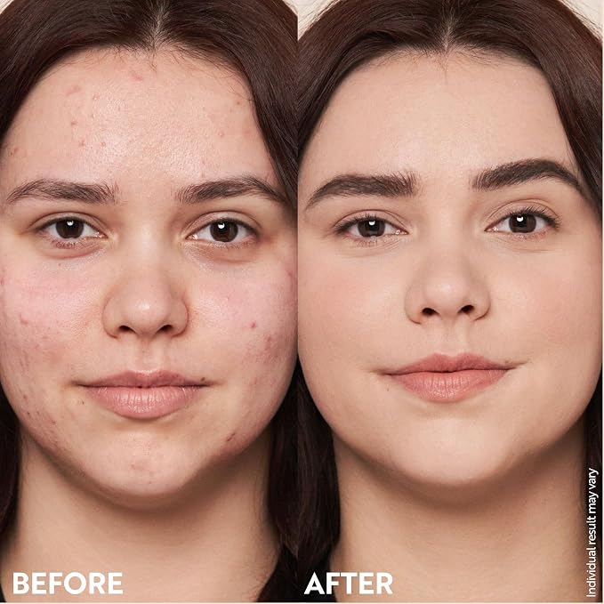 Light to medium skin tones