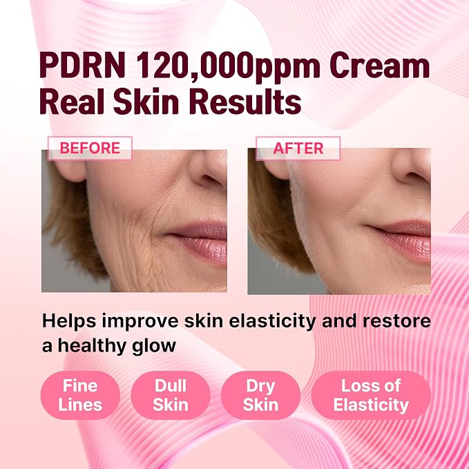 PDRN Cream