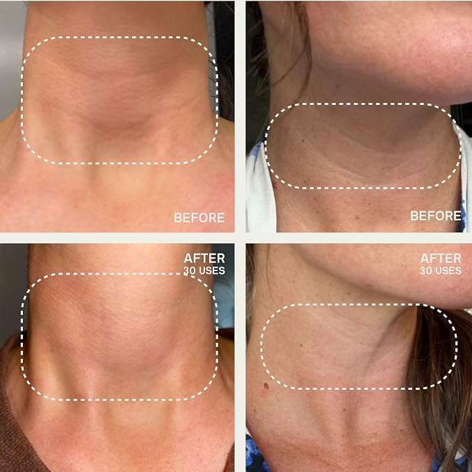 Neck Patches