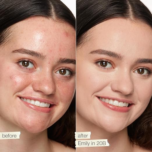 20B light (light skin with cool, pink undertones)