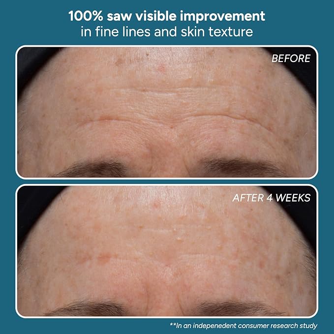 Sensitive-Dehydrated Skin