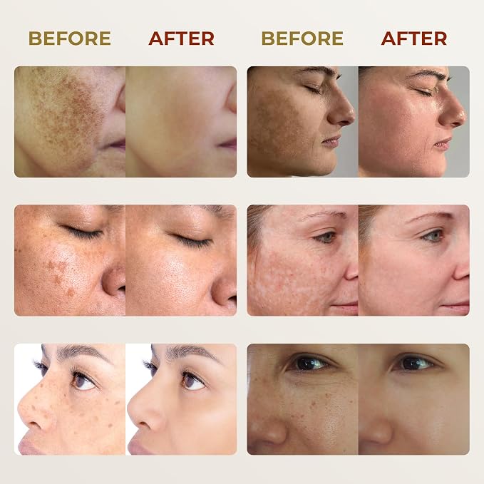 Set 3