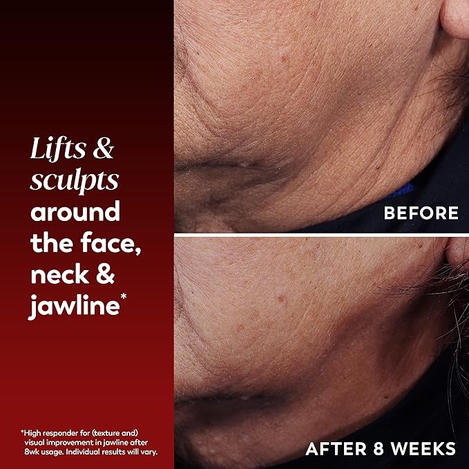 Face Lifting Treatment