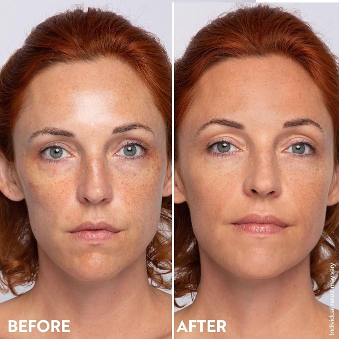 Medium to deep skin tones