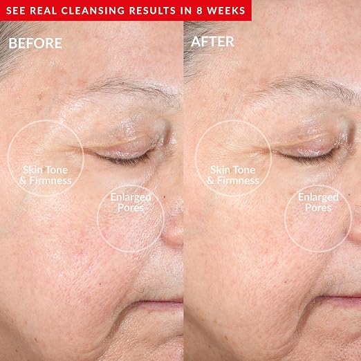 Cream With Remove Cleansing Balm