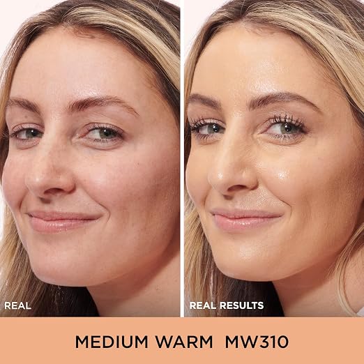 310 Medium Warm (medium with warm olive undertones)