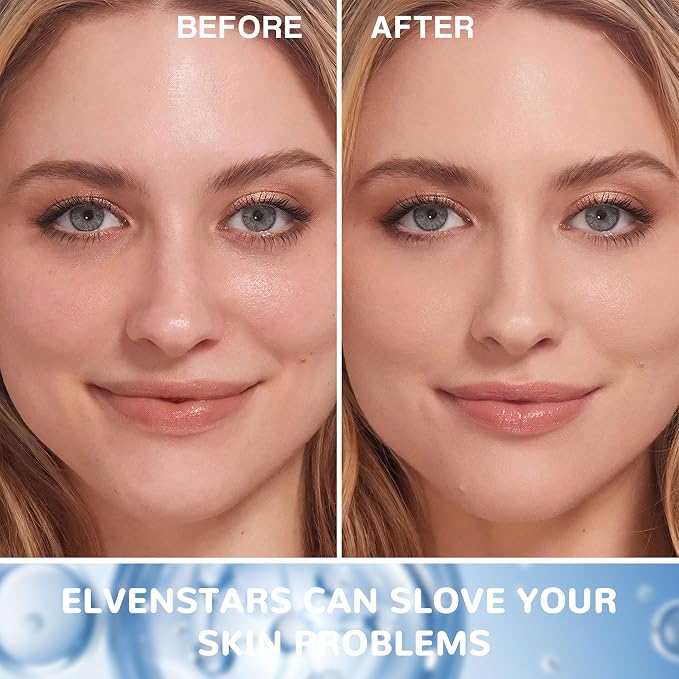 Hyaluronic Acid - 1 Pack